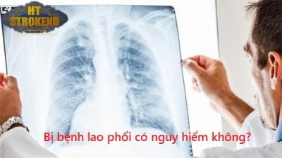 bệnh lao phổi